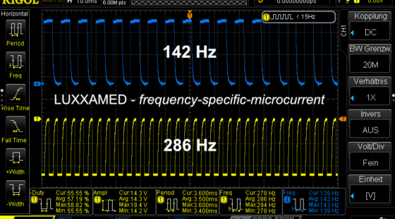 fsm-mikrostrom-frequenzen