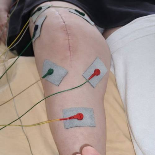 Mikrostrom in der Rehabilitation nach Knie-TEP